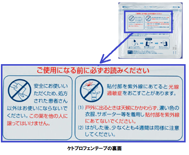 過敏 症 光線 お薬と光線過敏症