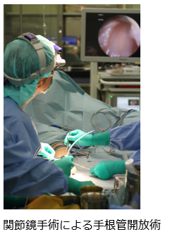 関節鏡手術による手根管開放術