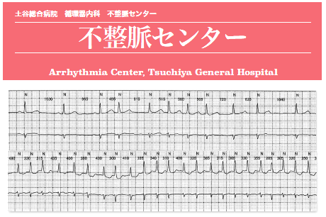 不整脈センター タイトルと心電図
