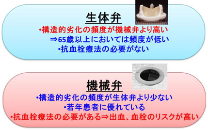 機械弁と生体弁それぞれの特徴