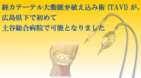 経カテーテル大動脈弁治療(TAVI)が、広島県下で初めて土谷総合病院で可能となりました