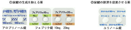 尿酸値を下げる薬