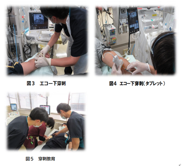 エコー評価