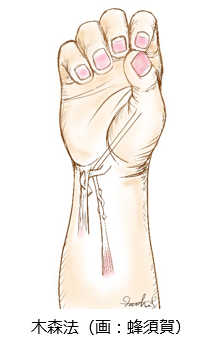 木森法（画：蜂須賀）